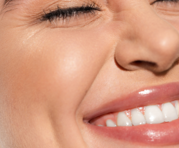 Beneficios del aumento de labios con ácido hialurónico en Holaglow